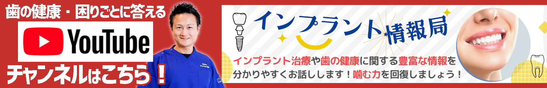 インプラント情報局