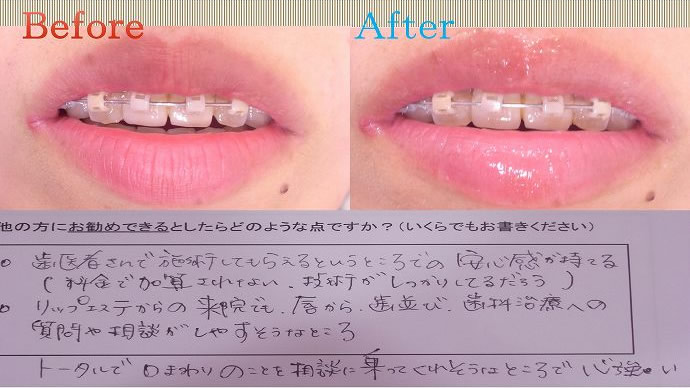患者様の声